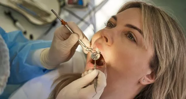 The Wisdom Tooth Removal Process at Our Newbury Park Office