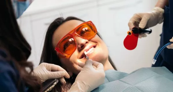 What is professional teeth whitening?