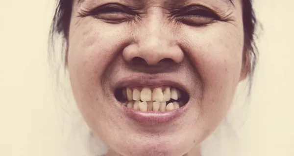 Who is a good candidate for veneers?