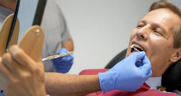 What is full mouth reconstruction?