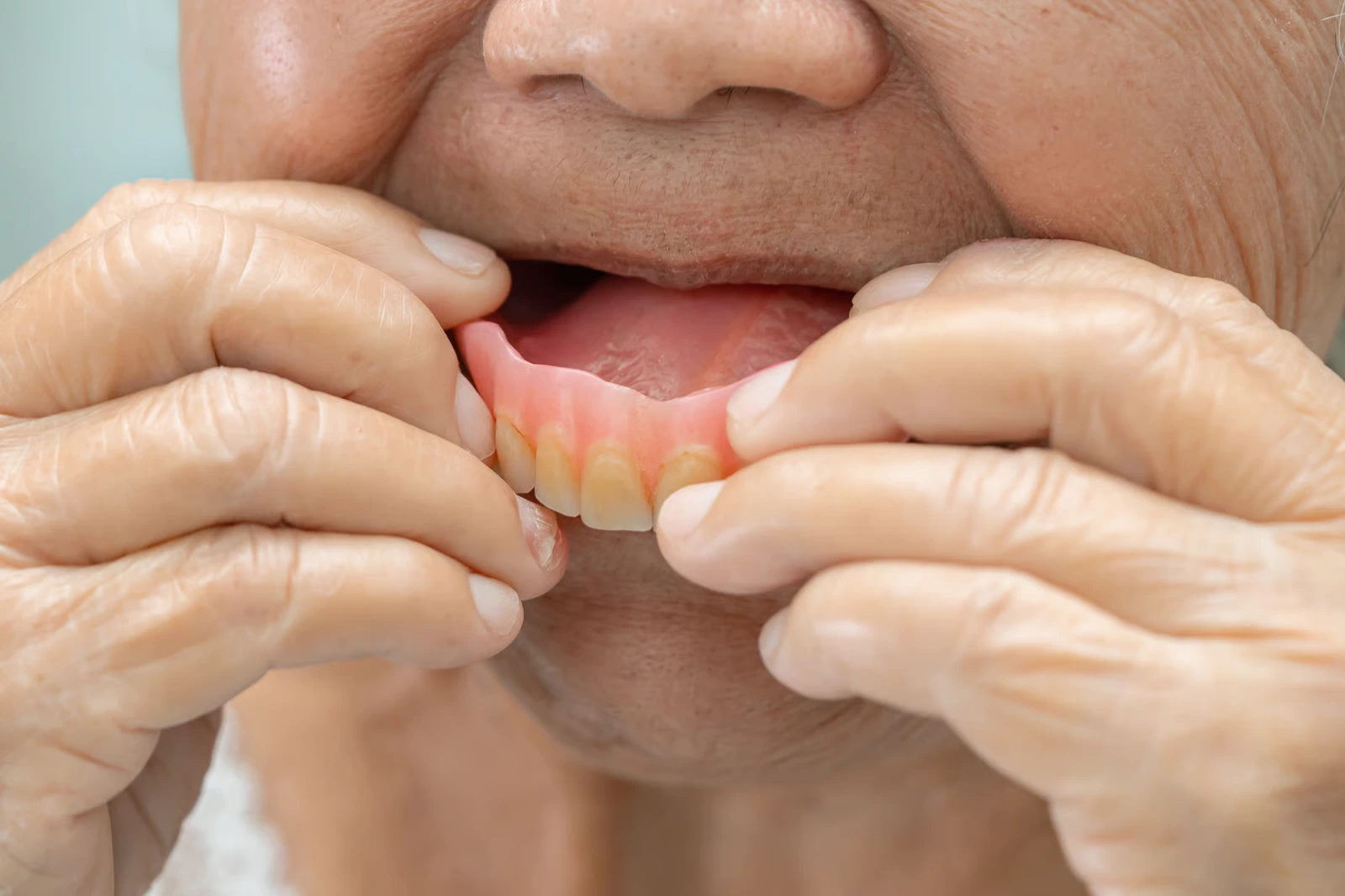 Dentures in Newbury Park