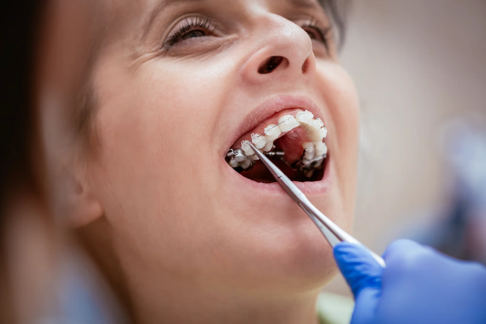 Clear Braces in Newbury Park