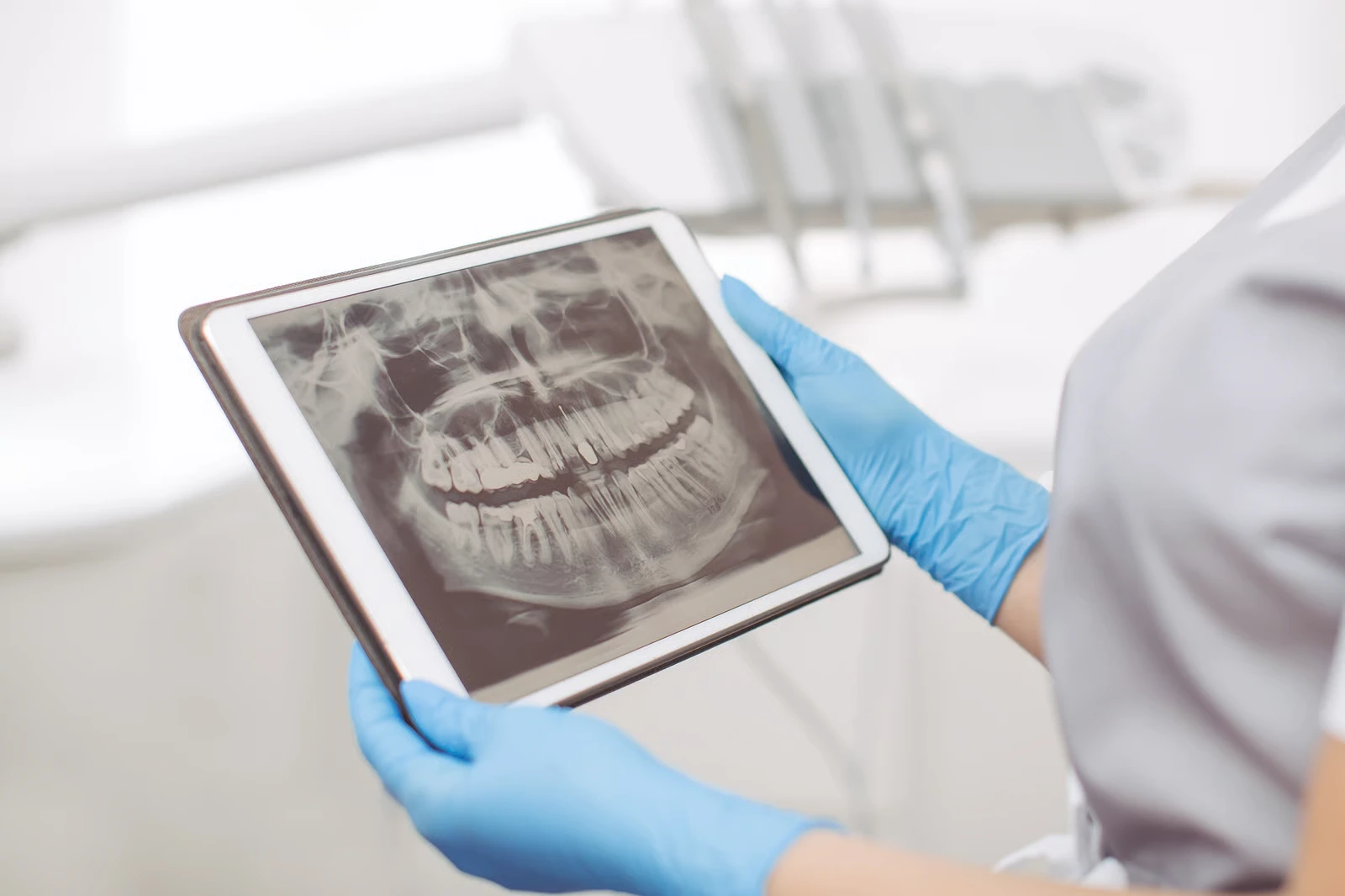 Radiografías Dentales en Thousand Oaks, CA