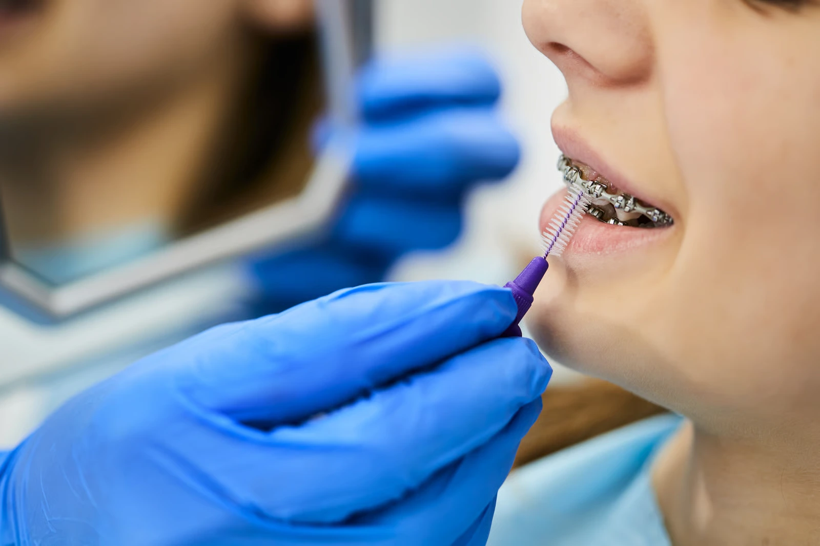 Orthodontics in Newbury Park, CA