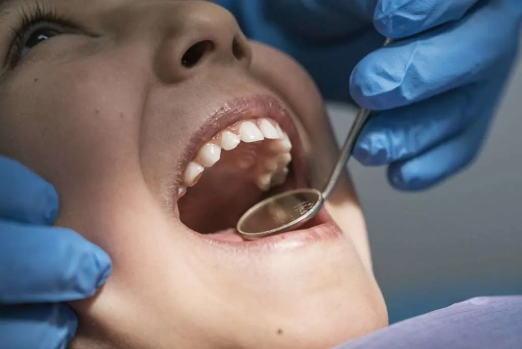 Teeth cleaning In Newbury Park