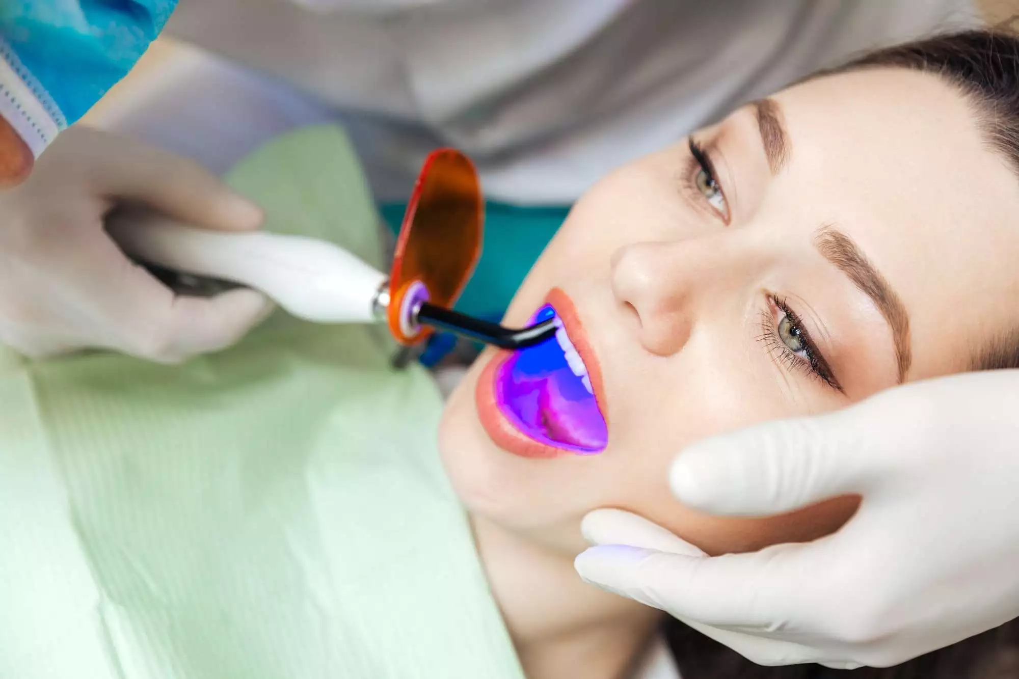 TEETH WHITENING