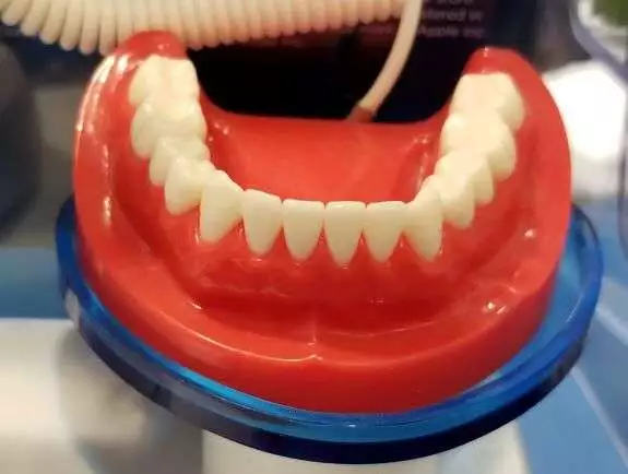 root canal