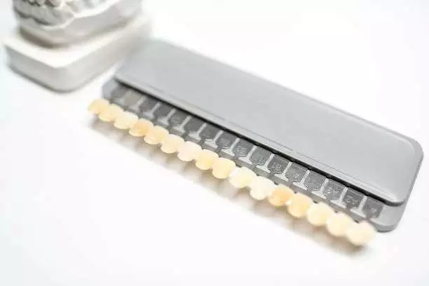 Dental veneers