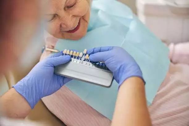 dental Veneers