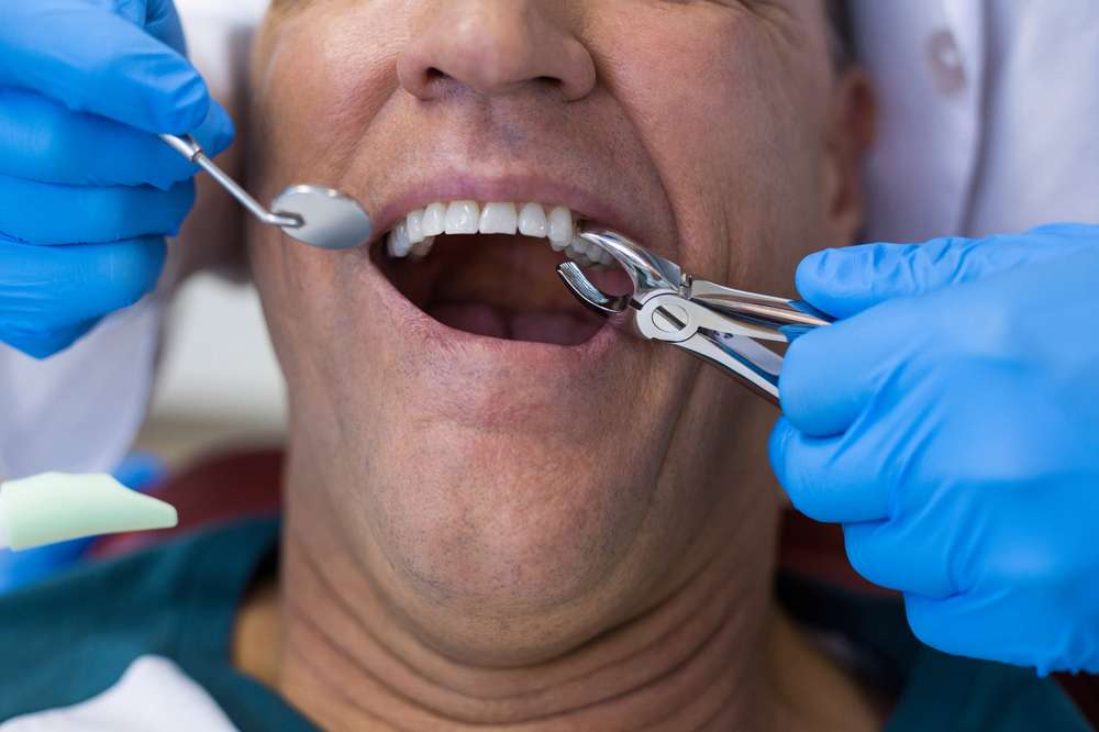 dental extractions in newbury park