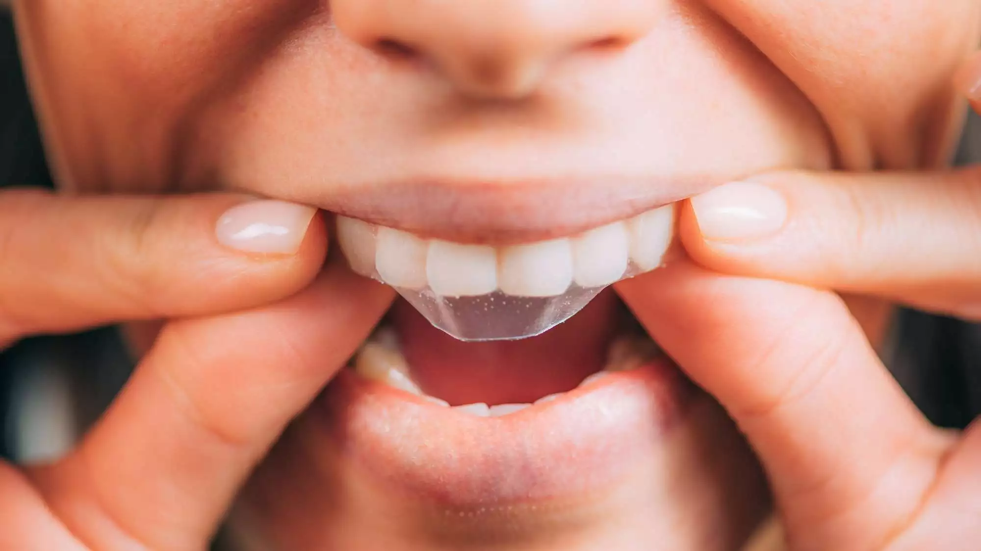 Whitening Strips