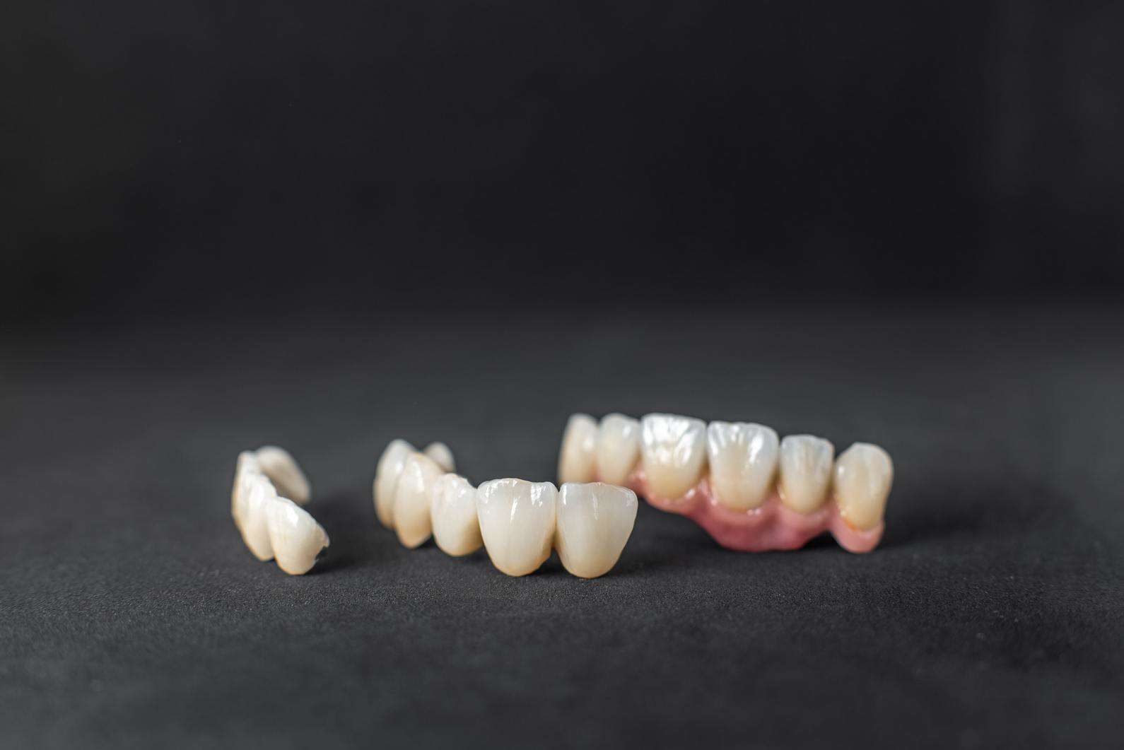 Dental crowns