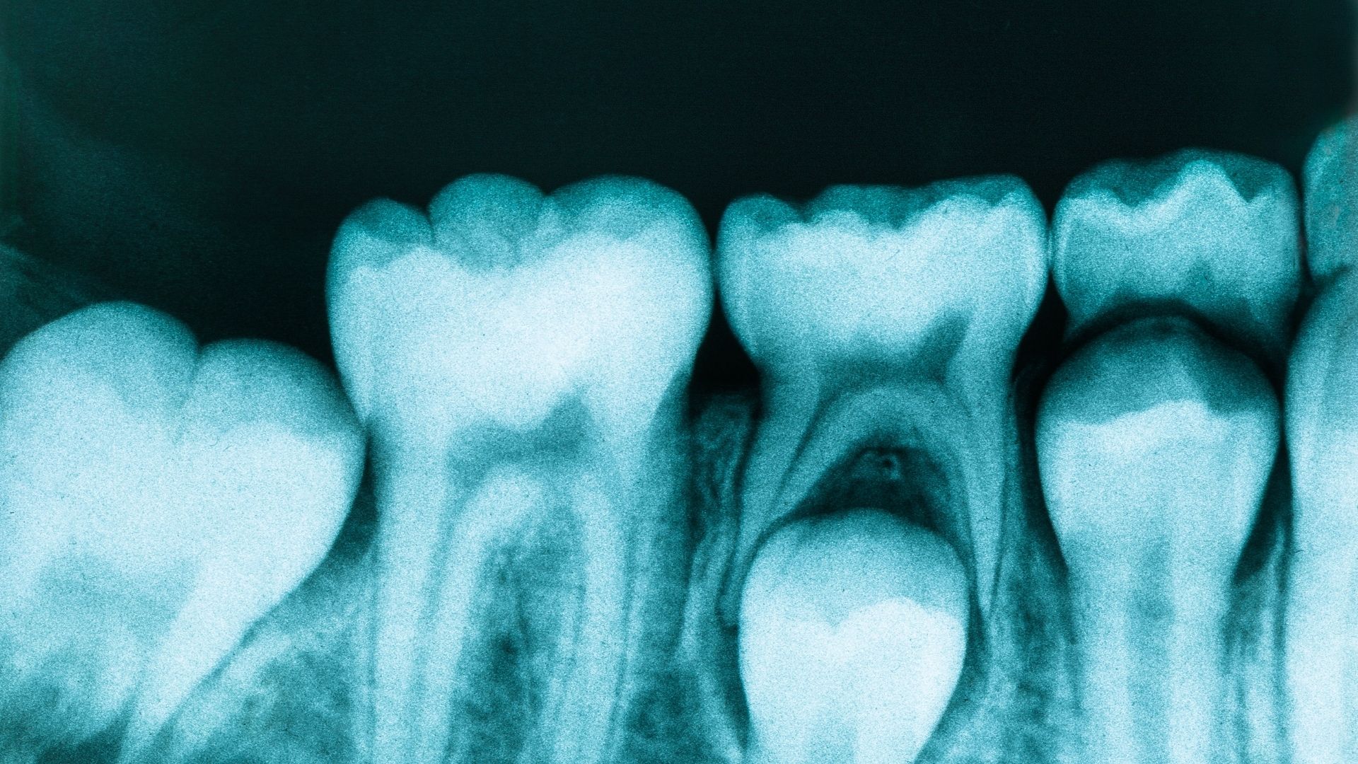 intraoral dental imaging