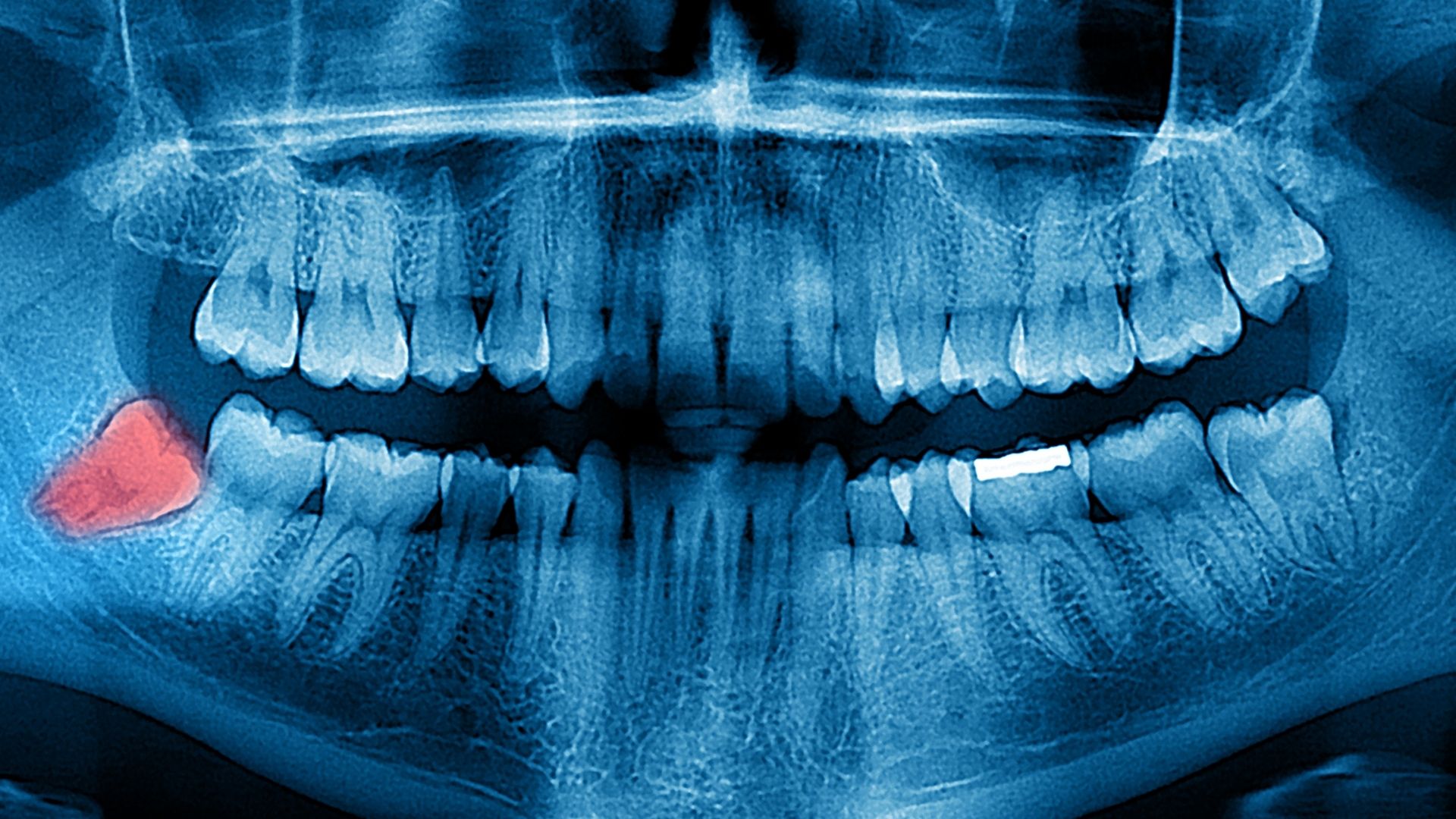 intraoral dental imaging