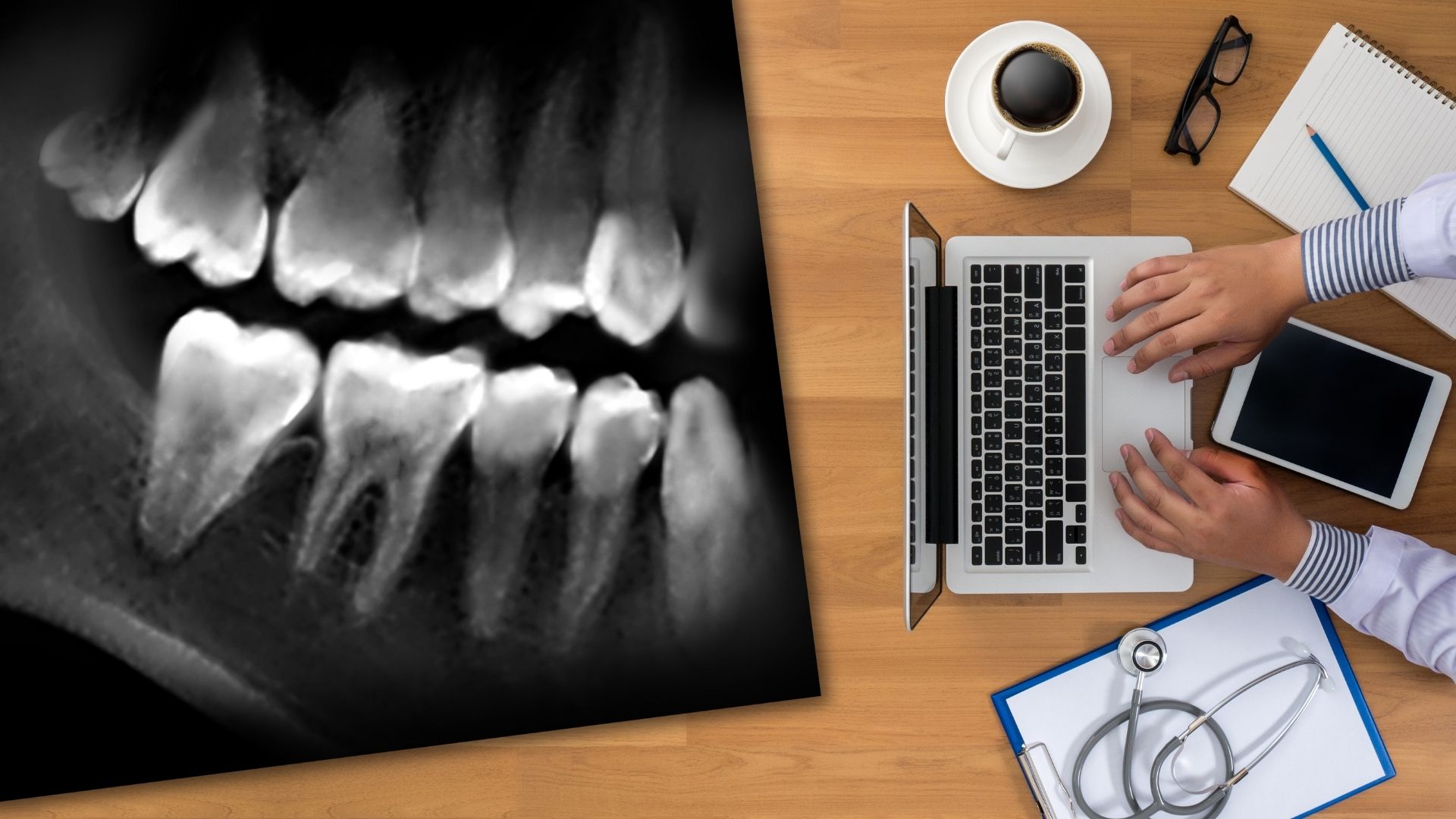 Best Intraoral Dental Imaging in Camarillo Newbury Dentist