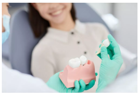 Dental Implants For Seniors - Implantes Dentales para Personas Mayores