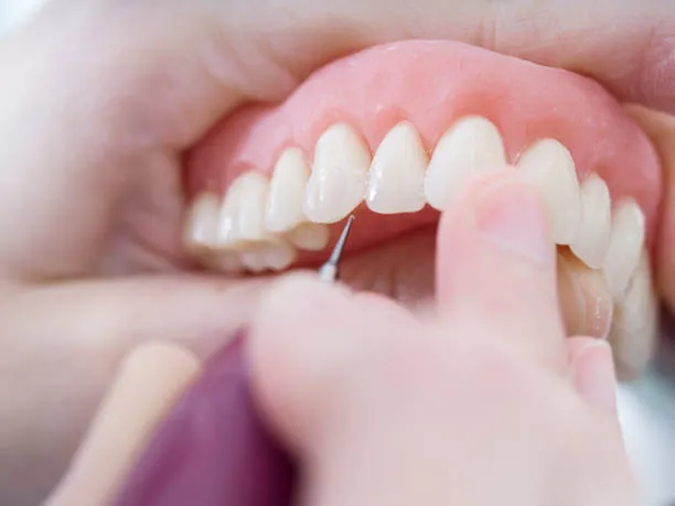 Denture Repairs