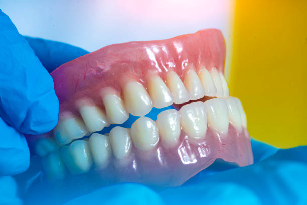 Remplazo de dentadura postiza