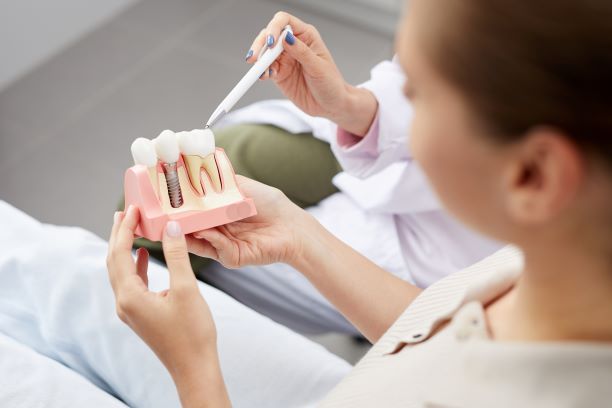 Dental Implant Model