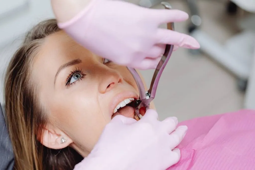 dental extractions in newbury park