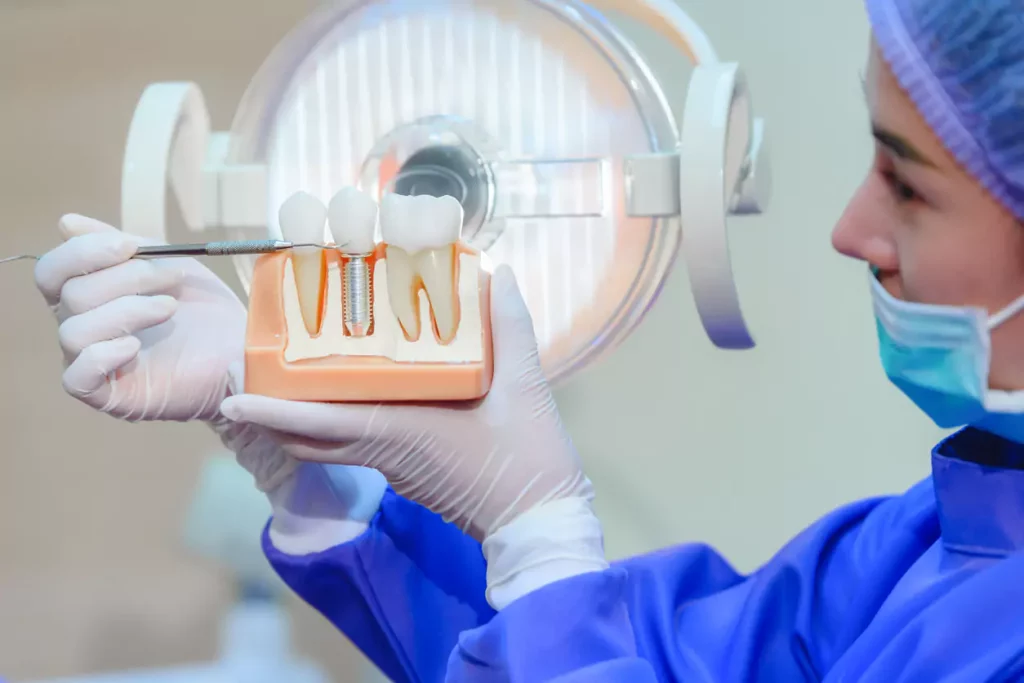 dental implants in camarillo