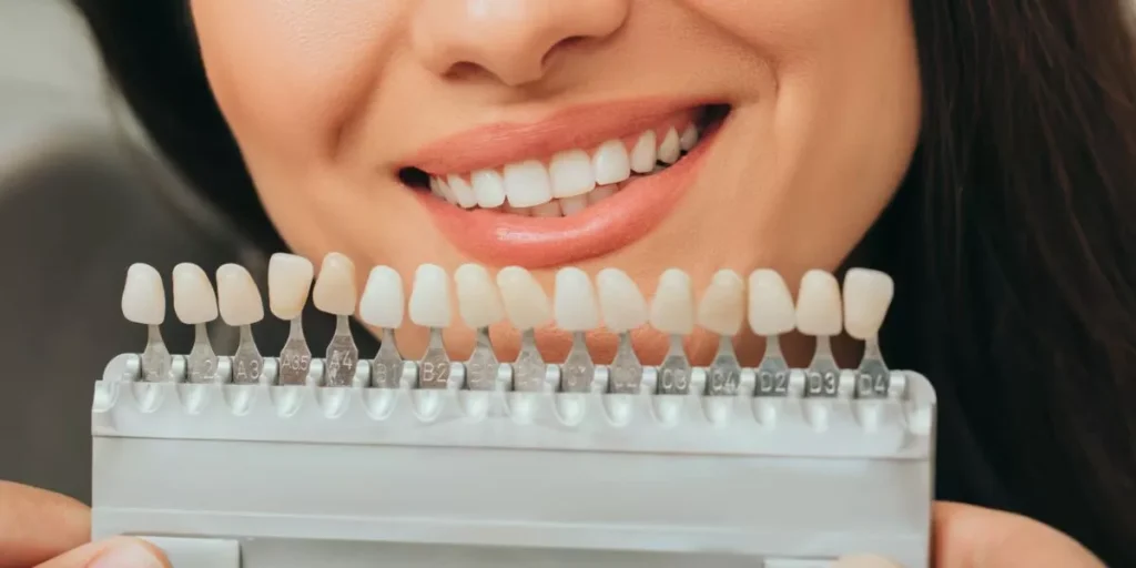 Dental Veneers in Thousand Oaks | Smile Makeover